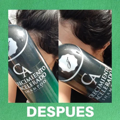 CRECIMIENTO ACELERADO SHAMPOO